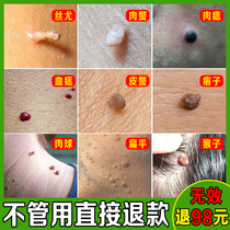 Wart-clearing cream removes the small warts and fleshy pimples on the monkeys neck a worry-free neck filiform wart artifact
