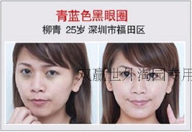 Zhuangdi Serum Mắt để Khử Mùi Tối Vòng Tròn Túi Mắt Dòng Fine Làm Săn Chắc Nhẹ Nhàng Thảo Dược Giải Pháp Chăm Sóc Mắt kem trị thâm mắt kumargic