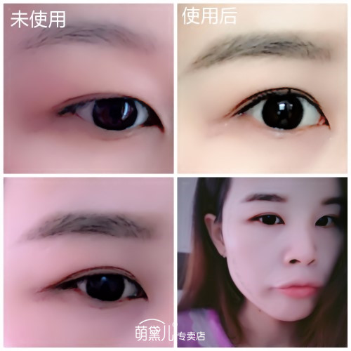 이중 보이지 않는 메쉬 메쉬 메쉬 이중 눈꺼풀 패치 아름다운 눈 패치 올리브 모양 비 반사 날짜 구덩이 모양 600 패치 열린 눈