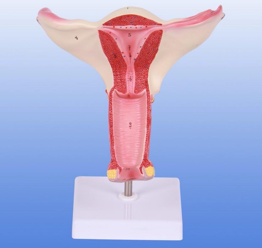 女性内生殖器病理模型 生殖器病理模型