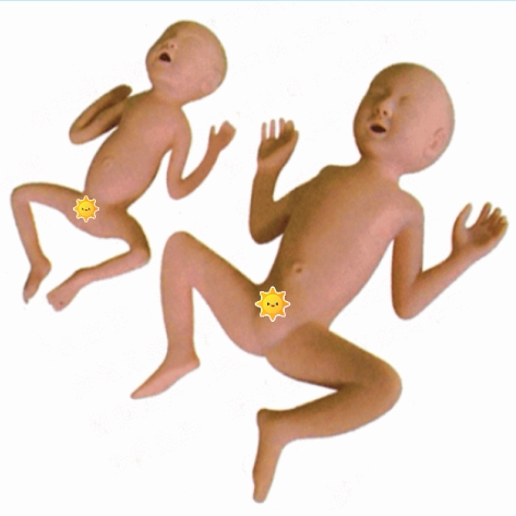 高级30周早产儿模型出生婴 儿模型