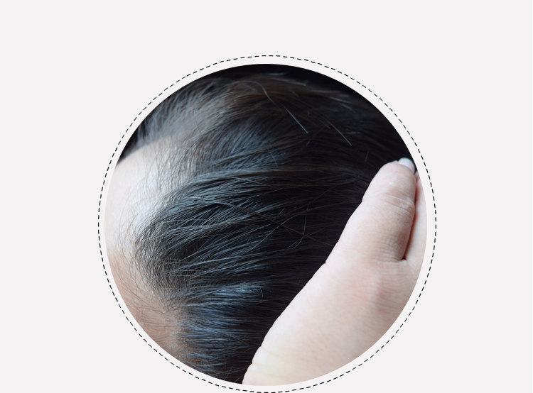 Extension mèches - Ref 217646 Image 16