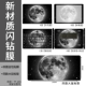 ☆ Обновите пленку Flash Diamond ☆ ABCD Four Sides+Те же самые мышиные прокладки [заменить изображение] [Отправить пакет для очистки инструментов]