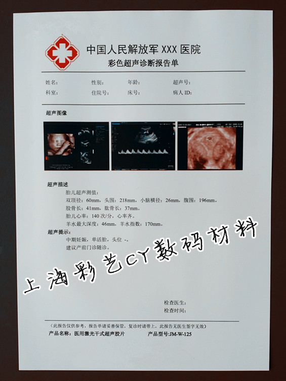 High light porcelain white A4 210 * 297 medical color printing negatives B supercolor ultra medical negatives (17 5S)