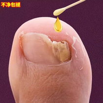 (Japanese technology research and development) One drop of it inhibits bacteria without removing armor and removes 99% of gray potassium fungi. Return guarantee if ineffective.