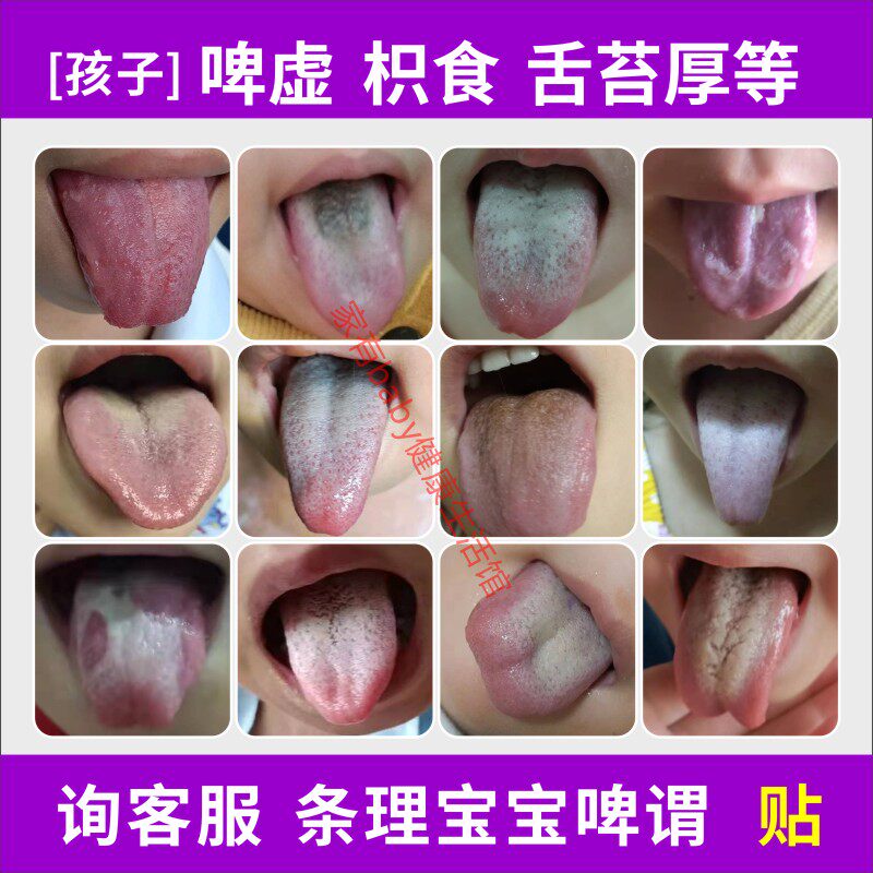 By the body of children's food, the temper and stomach to the children's spleen and plaster diet, heat on the tongue and tongue thick white yellow black