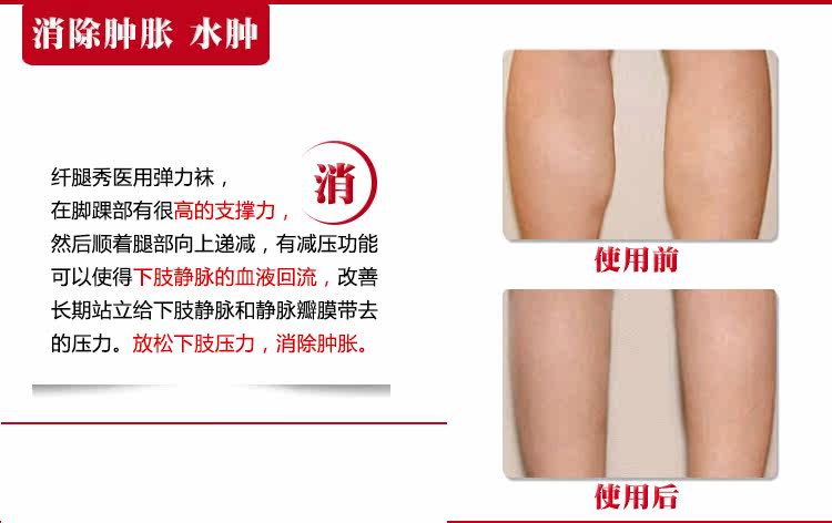 Chaussettes - collants manchon médical de veau - Ref 753919 Image 32