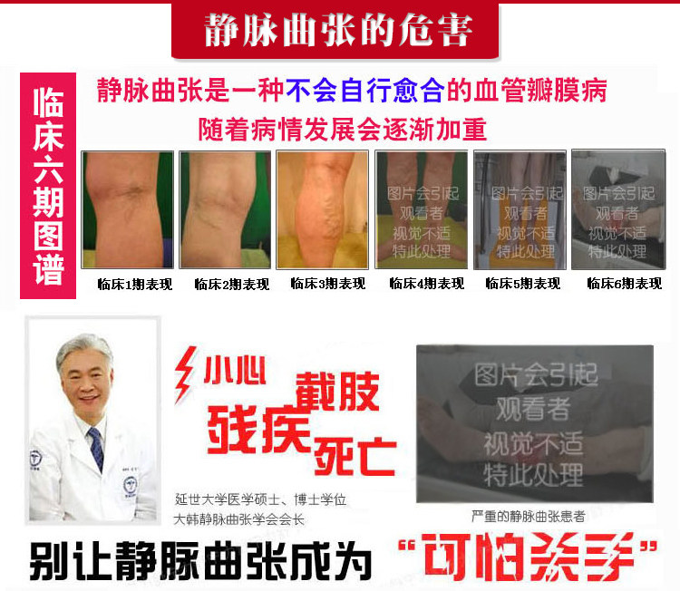 Chaussettes - collants manchon médical de veau - Ref 753919 Image 22