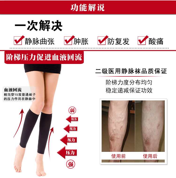 Chaussettes - collants manchon médical de veau - Ref 753919 Image 31