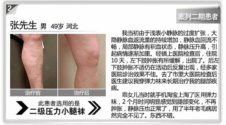 Chaussettes - collants manchon médical de veau - Ref 753919 Image 30