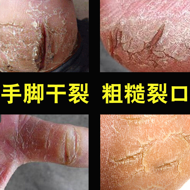 Horse oil paste autumn and winter hands and feet cracked opening dry cracked dry peeling rough cracks heel anti-crack paste repair deviner