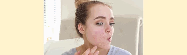 Séc 黛 Czech dermacol che khuyết điểm che khuyết điểm bút xăm che vết mụn tàn nhang mặt mụn trứng cá nữ