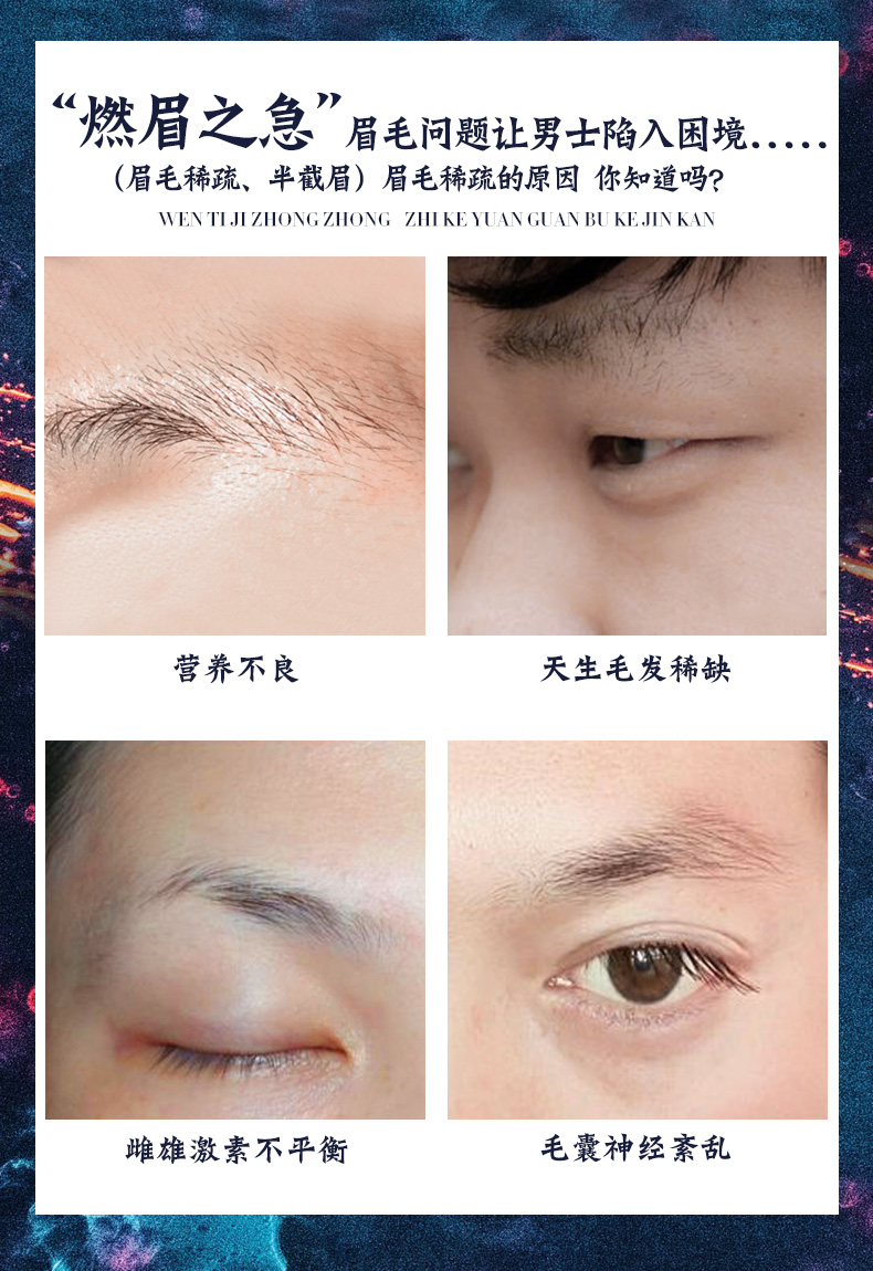 Hoàng đế Lông mi Curl Tăng trưởng Chất lỏng Sợi dài Nuôi dưỡng Lông mày Tăng trưởng Chất lỏng Kem chống thấm dày Tóc nam - Kem Mascara / Revitalash chuốt mi lameila