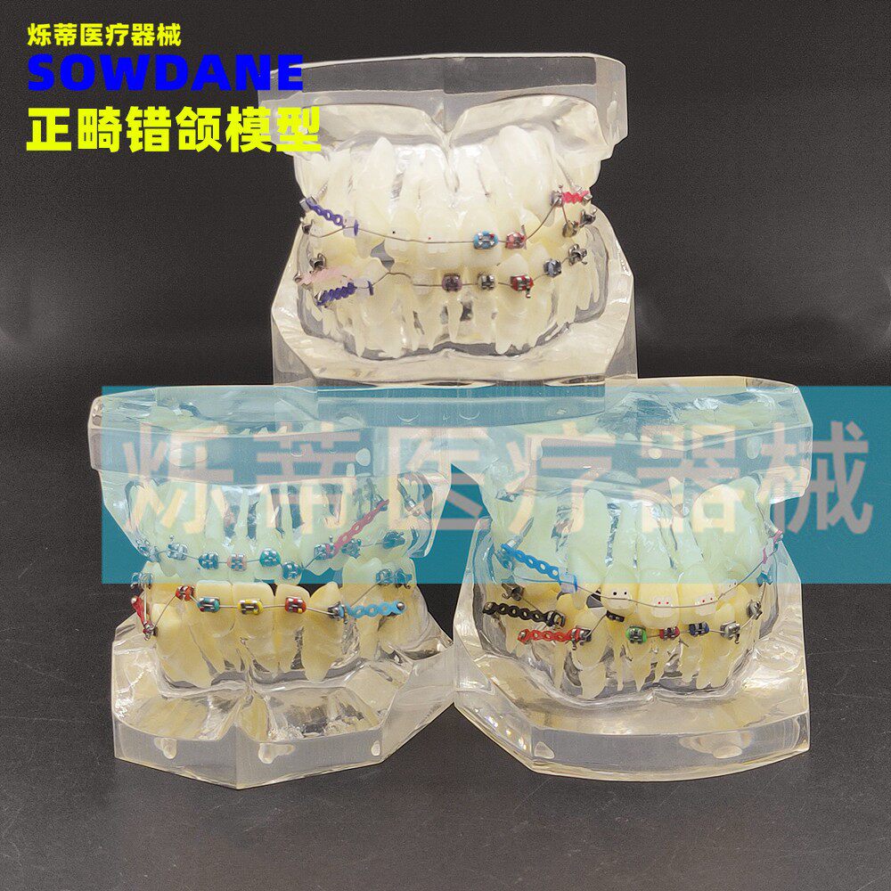 牙科正畸错颌畸形带拔牙托槽模型带钉透明牙模病理分析医患沟通教