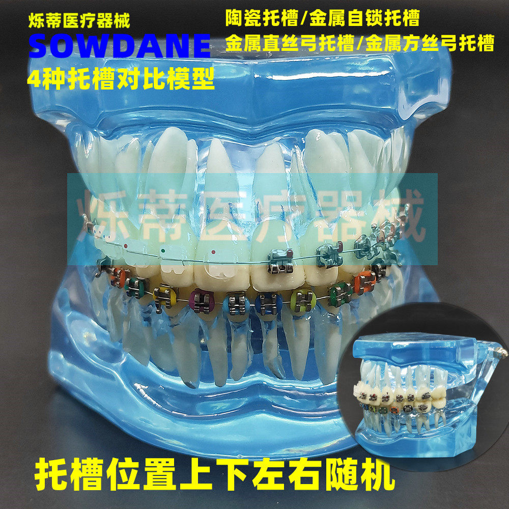 Dental Orthodontics Model Metal Self-Lock Ceramic Nursery Trough Metal Groove Contrast Model Dental Model Teaching Doctor-patient Communication