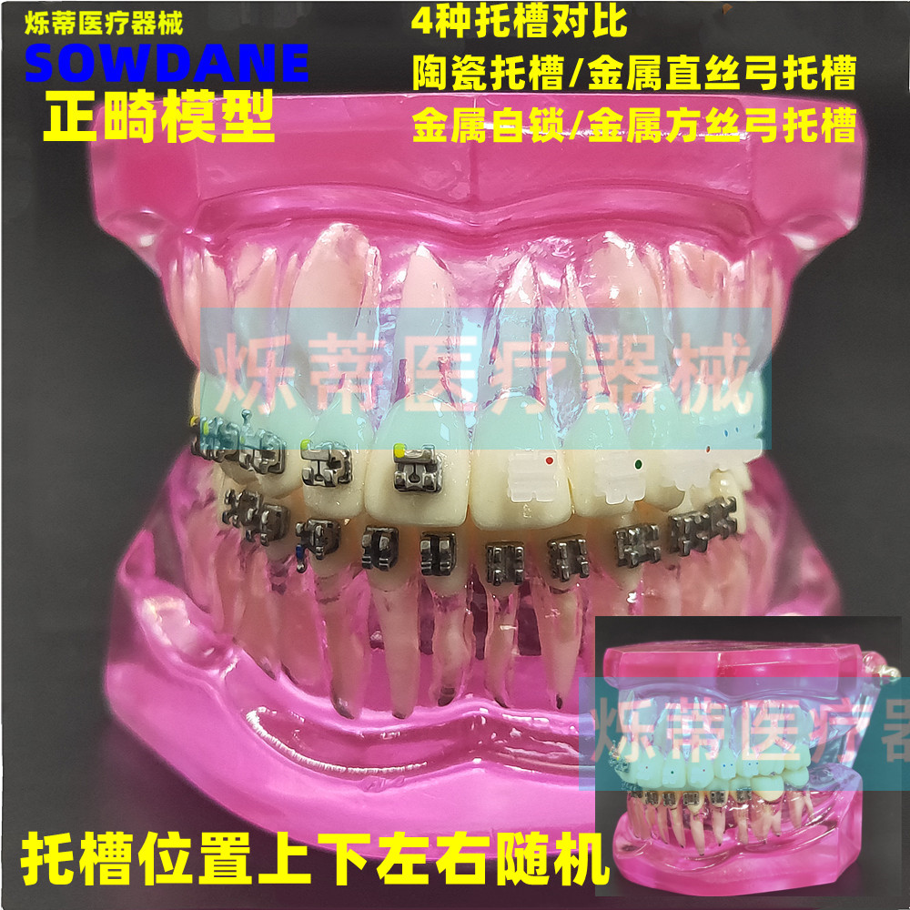 牙科正畸模型金属托槽陶瓷托槽红色透明4对比牙模教学讲解医患