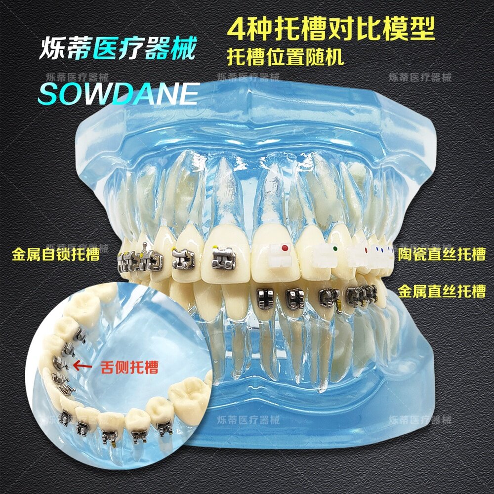 牙科矫正正畸牙模型4种托槽对比模型医患沟通展示舌侧模型齿科