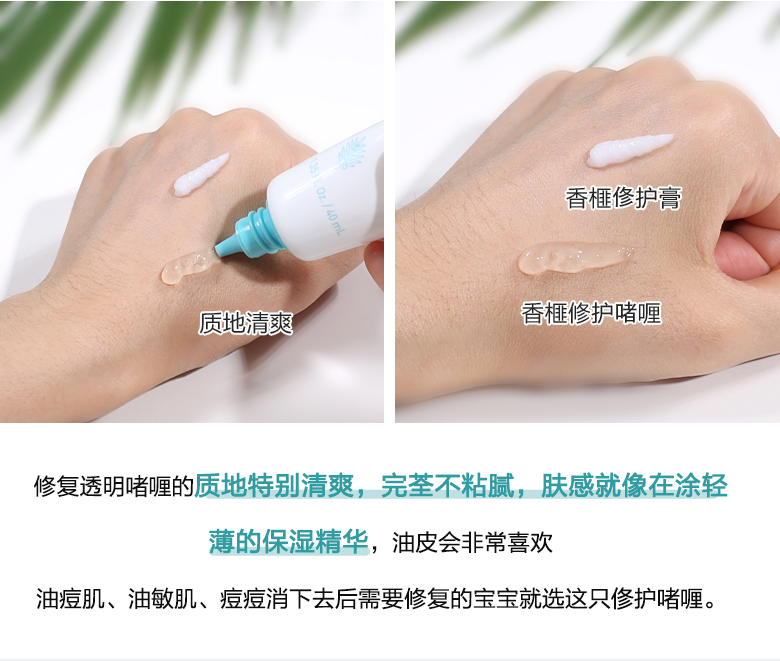 Hàn Quốc Innisfree Yue Shi Feng Xiaoli ống trắng thơm thuốc mỡ acse tinh chất sửa chữa cica kem