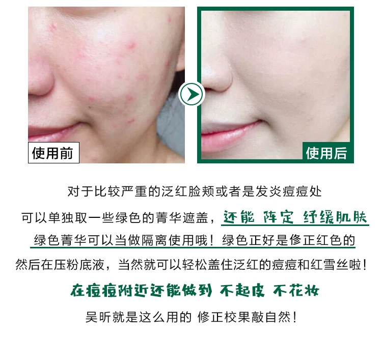 Hàn Quốc VT Fant Tiger đệm Centella asiatica mạnh mẽ che khuyết điểm giữ ẩm lâu dài BB cream sinh viên trị mụn cơ bắp dạng lỏng