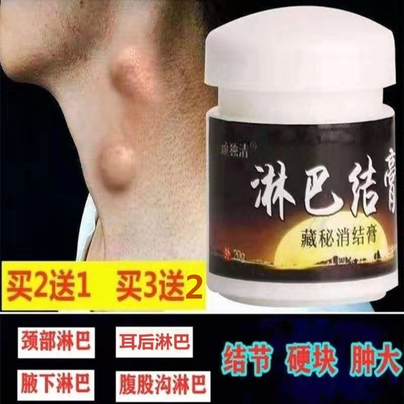 Lymph node elimination cream eliminates auxiliary milk artifact swollen neck and armpit special lymph node dredging artifact lymphatic Sanjie cream