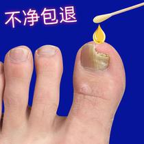 No guarantee no repair just one drop in the morning and evening the effect is so good bad nails turn into good ones fingers and toes are repaired and turned into good ones.