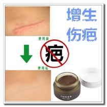 Go to the face Scar Print Dispel Scalds Scars Hearty Repair Cream Surgery Proliferative Bumps Physique Child Sticker
