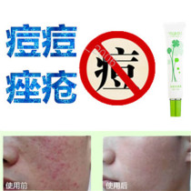 Miracle herbs remove acne remove wine thorns on the front chest and back remove teenage acne blackheads flattened fat particles and acne scars