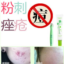 Acne Acne Print and Acne Scar Product Essence Doyinli Elimination Remove Back Pigmentation Remove Rosacea Acne