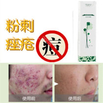 Acne scar repair products acne marks acne scars acne pits teen acne acne dilution scar blackheads acne for men and women