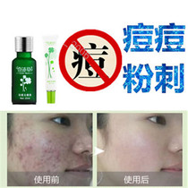 Remove blackheads for men and women closed acne acne products acne acne childrens acne bean repair cream