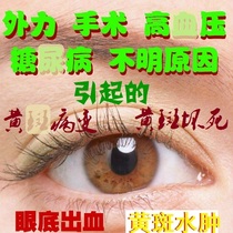 Macular necrosis macular degeneration macular hole fundus hemorrhage macular hemorrhage macular edema red eyes