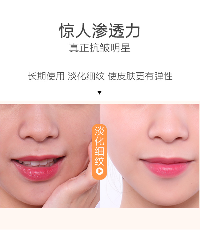 Aussie Six-Peptide Tinh chất chống nhăn Hyaluronic Acid Giải pháp chứng khoán Firming Pore Desalination Nâng nâng mũi Làm săn chắc serum rau má