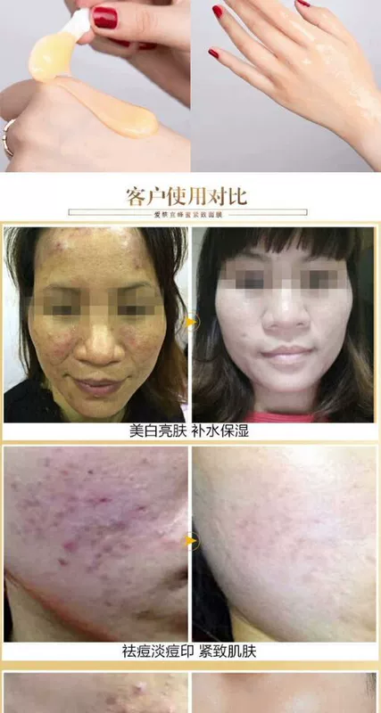 Yêu làn da nên dưỡng ẩm sâu làm đẹp da mặt 120g dưỡng ẩm trắng loại bỏ da chết mặt nạ sừng đen. - Mặt nạ