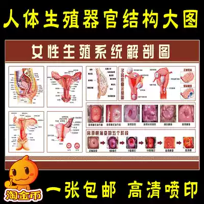 Female reproductive system structure anatomical diagram poster posters, cervical disease erosion diagram, wall stickers