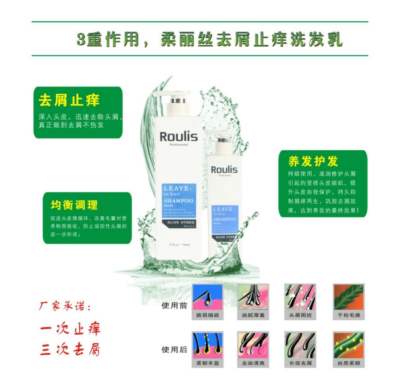 Zulis detrimental to the itch shampoo hair shampoo efficacy type detriment to the itching health hair care 780