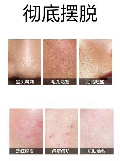 Deep Cleansing Facial Pore Dirt Blockage Deep Cleansing Skin Clearing Cream Massage Cream Detoxifying Facial Authentic Product