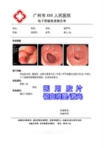 Hospital film inkjet laser porcelain white translucent color gastroscope B ultrasound four-dimensional color ultrasound printing film paper A4