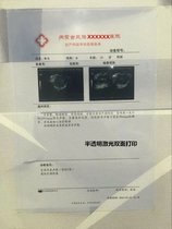 Semi-transparent frosted film paper Color laser duplex printing film B-color ultrasound gastroscope hospital film