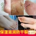Kem dưỡng ẩm chân chống khô sửa chữa chăm sóc chân Kem dưỡng chân giúp nứt nẻ gót chân cho nữ da chết kem dưỡng da tay chân Trị liệu chân