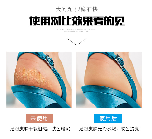 Kem dưỡng da chân khô của Đức Jiewo chăm sóc da khô chân nứt khô chân nứt nẻ bàn tay và bàn chân khô nứt kem 40ml thuốc bôi nứt gót chân