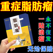 Lipoma removal of subcutaneous hard lump artifact traditional Chinese medicine to treat multiple lipoma special anti-tumor plaster paste
