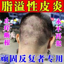 Hair folliculitis dandruff seborrheic seborrheic dermatitis to eradicate dedicated shampoo over head long pimple follicles