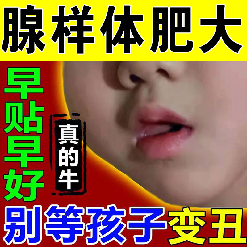 (Pluck the root without regenerating the hair) Adenoid hypertrophy Chinese medicine patch for children sleeping with open mouth, breathing and snoring, conditioning nasal congestion