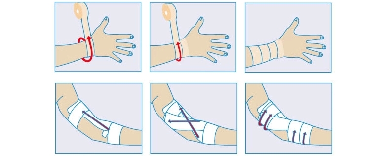 Protection sport - Ref 586235 Image 11