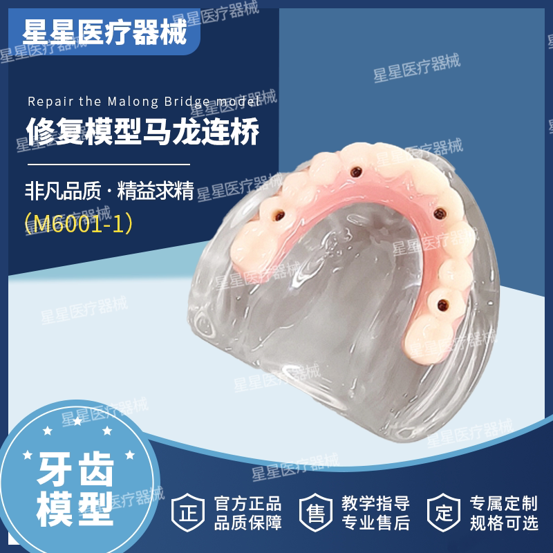 Dental Oral Model Half-Mouth Malong Partial Denture Bridge Restoration Implant Tooth Simulation Teaching Doctor-Patient Communication Dental Oral Model Half-Mouth Malong Partial Denture Bridge Restoration Implant Tooth Simulation Teaching Doctor-Patient Communication