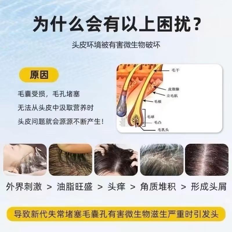 跑腿!复方侧柏酊侧伯叶洗发水非上海育发液测柏叶非中药材洗涂抹怎么用才有效?新手必看保姆级指南!_头发护理_淘宝美妆网