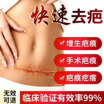 Japanese scar paste Caesarean section to scar surgery scar special hyperplasia scar bulge to remove scar eight boxes