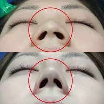 Li Jiaqi with the same kind of say goodbye to the ugly nose~nose artifact and collapsed nose bridge say goodbye