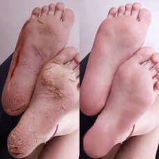 Перчатки 【买二送一】手脚干裂 一抹恢复 嫩滑脚后跟滋润保湿护足霜护手霜 Nine futang