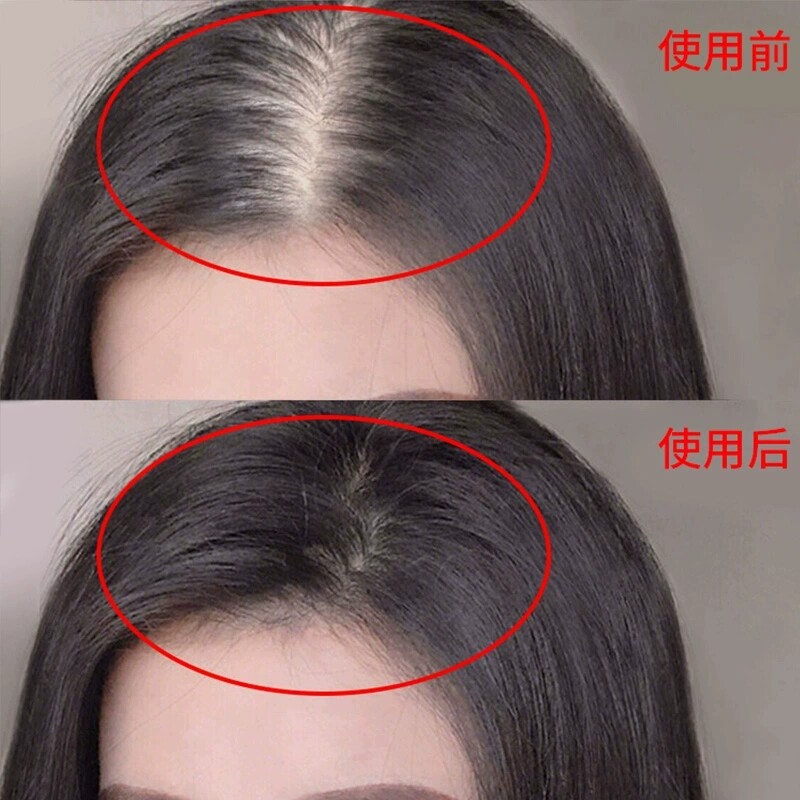 (Li Jiaqi recommended) ginger shampoo soaps to save bald hair natural growth Men and women are available